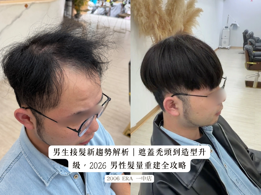男生接髮新趨勢解析遮蓋禿頭到造型升級