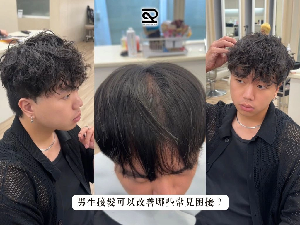 男生接髮可以改善哪些常見困擾?